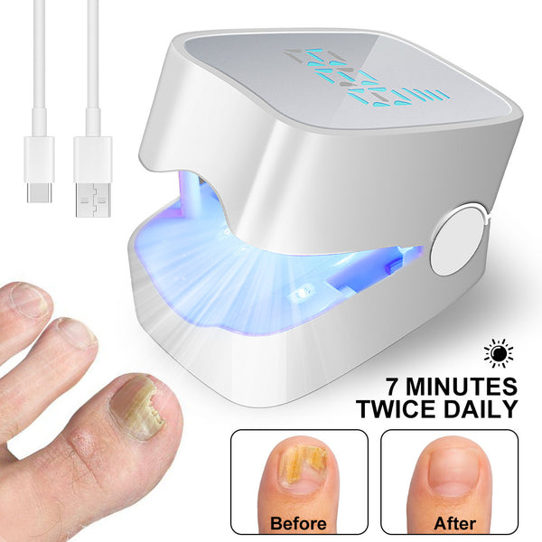 Nail Fungus Cleaning Laser Device |Nail Fungus Treatment Tool With Blue Light Therapy For Onychomycosis Repair | Rechargeable, Portable And Treatment for Nail Fungus